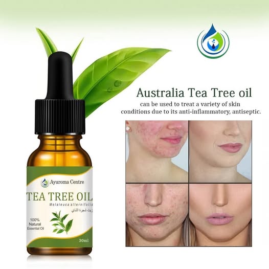 Tea Tree Essential Oil